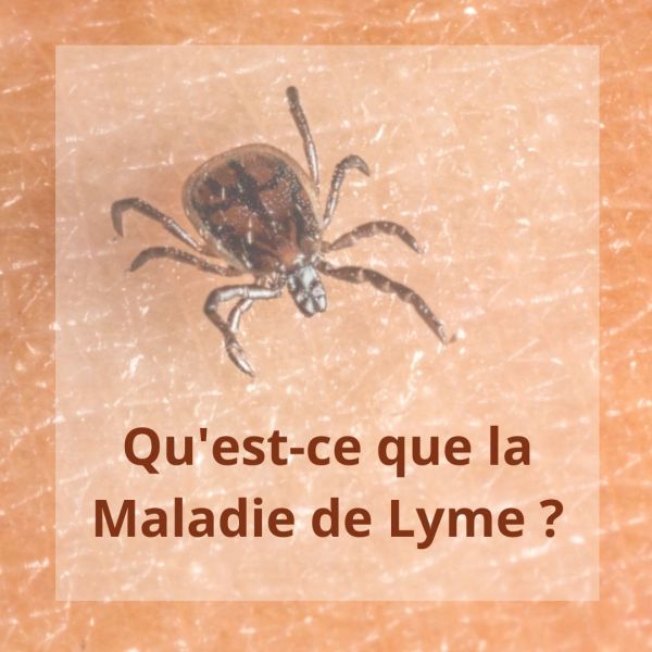 Qu'est-ce que la maladie de Lyme ?