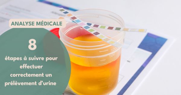 Vous devez réaliser un prélèvement d’urine ?