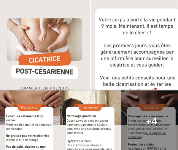 Vous venez d’accueillir votre bébé par césarienne ? 💕