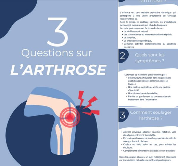3 questions sur l’arthrose